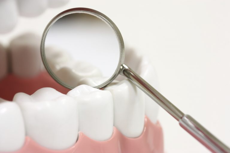 Зубные герметики – надежная защита с самого детства